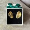 aretas